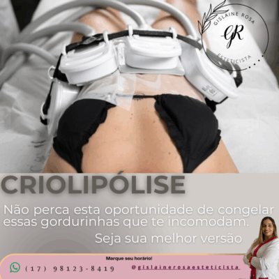 Criolipólise com Placas: o tratamento que congela gordura e remodela o corpo