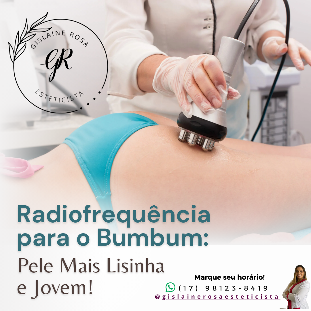Radiofrequência para o Bumbum: firmeza e contorno sem cirurgia